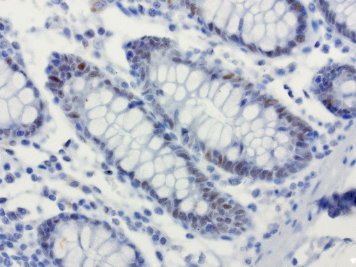 XRCC1 Antibody in Immunohistochemistry (Paraffin) (IHC (P))