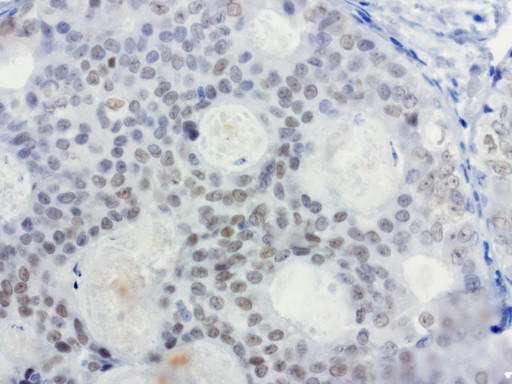 XRCC1 Antibody in Immunohistochemistry (Paraffin) (IHC (P))