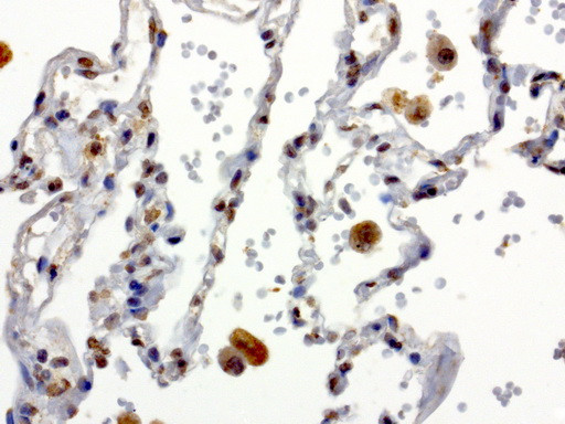 XRCC1 Antibody in Immunohistochemistry (Paraffin) (IHC (P))