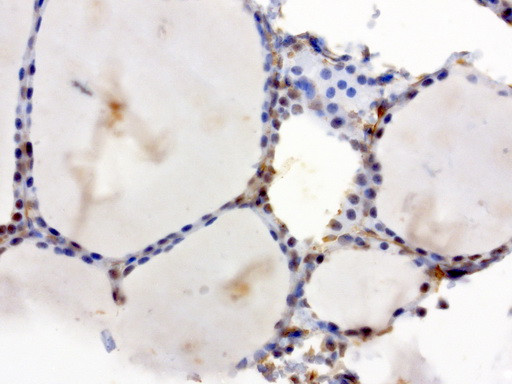 XRCC1 Antibody in Immunohistochemistry (Paraffin) (IHC (P))