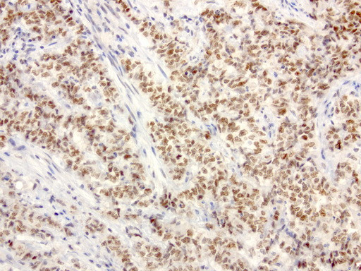 XRCC1 Antibody in Immunohistochemistry (Paraffin) (IHC (P))