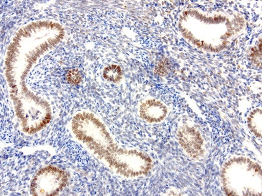 XRCC1 Antibody in Immunohistochemistry (Paraffin) (IHC (P))