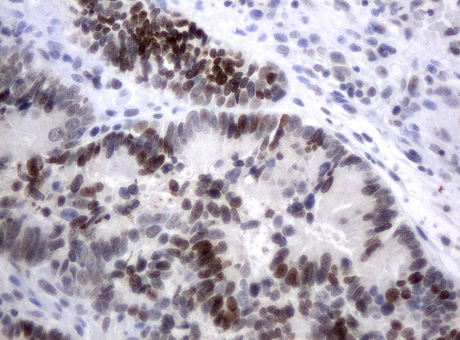 XRCC1 Antibody in Immunohistochemistry (Paraffin) (IHC (P))