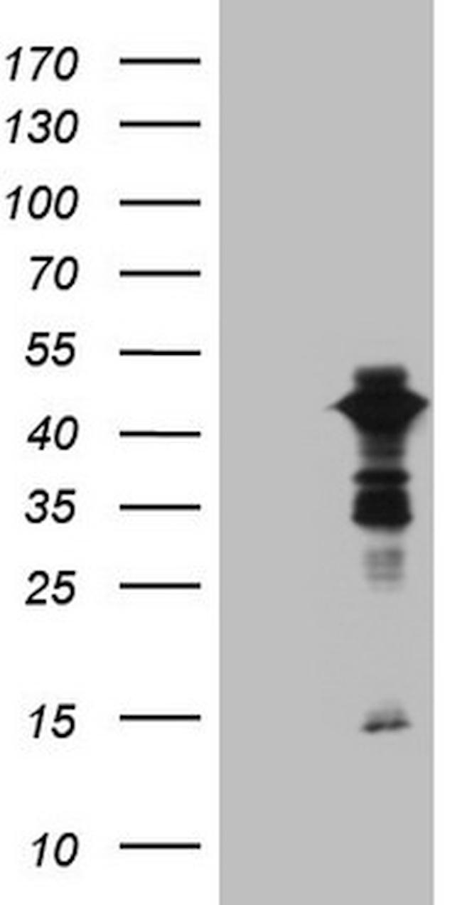 XRCC3 Antibody in Western Blot (WB)