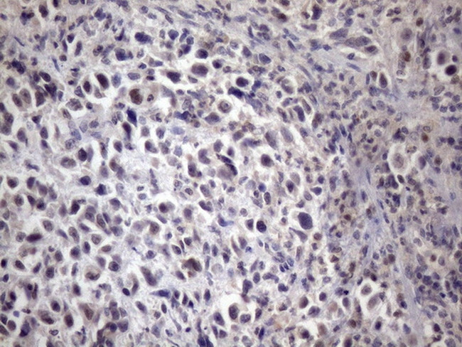 XRCC6BP1 Antibody in Immunohistochemistry (Paraffin) (IHC (P))