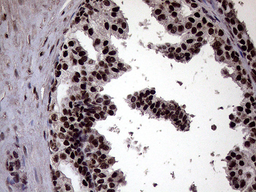 XRN2 Antibody in Immunohistochemistry (Paraffin) (IHC (P))