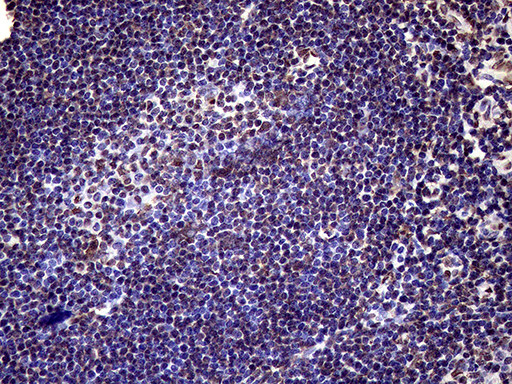 XRN2 Antibody in Immunohistochemistry (Paraffin) (IHC (P))