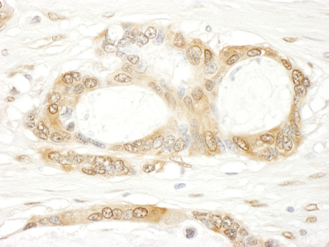 YAP1 Antibody in Immunohistochemistry (IHC)