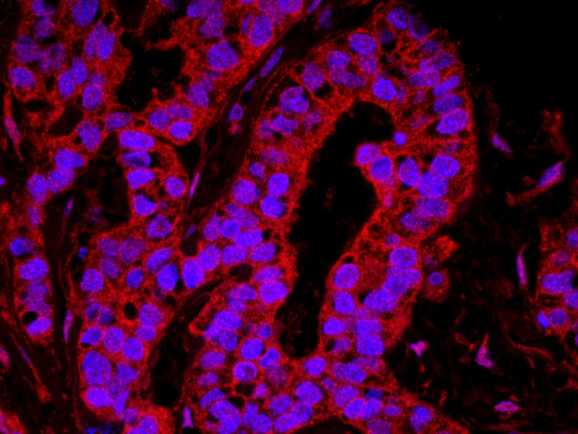 YAP1 Antibody in Immunohistochemistry (IHC)