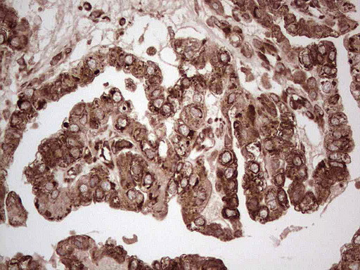 YBX1 Antibody in Immunohistochemistry (Paraffin) (IHC (P))