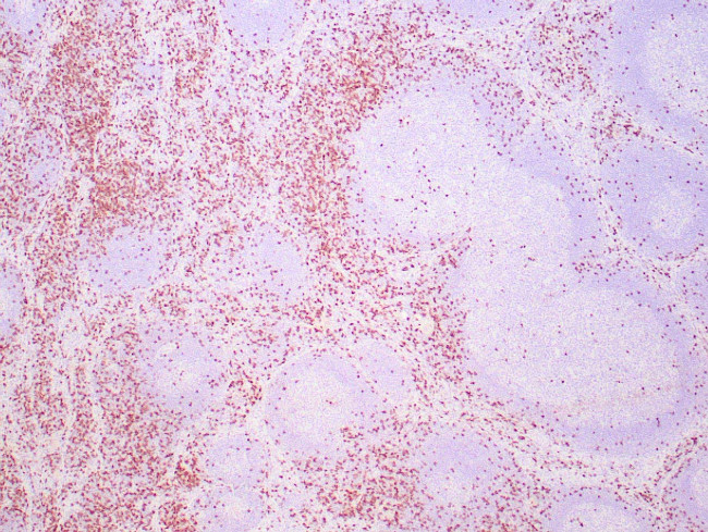 CD8 Antibody in Immunohistochemistry (Paraffin) (IHC (P))