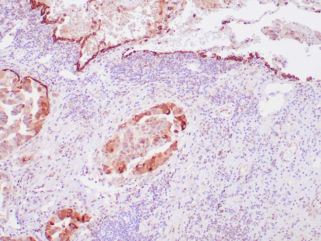 Surfactant Antibody in Immunohistochemistry (Paraffin) (IHC (P))