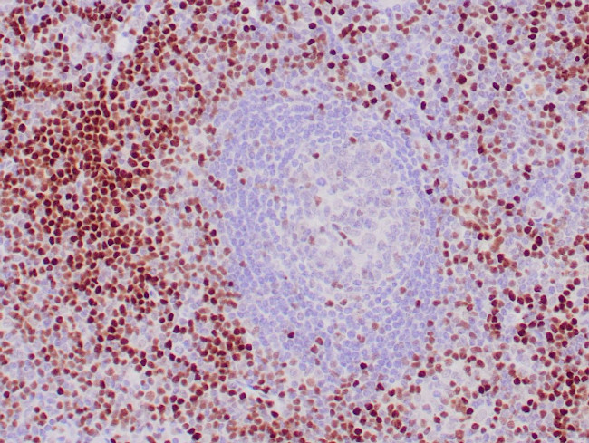 LEF1 Antibody in Immunohistochemistry (Paraffin) (IHC (P))