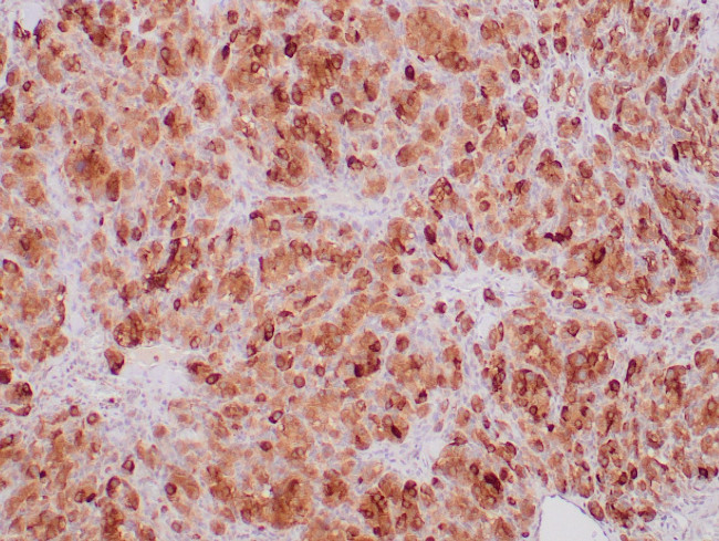 SDHB Antibody in Immunohistochemistry (Paraffin) (IHC (P))