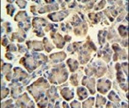 ZACN Antibody in Immunohistochemistry (IHC)