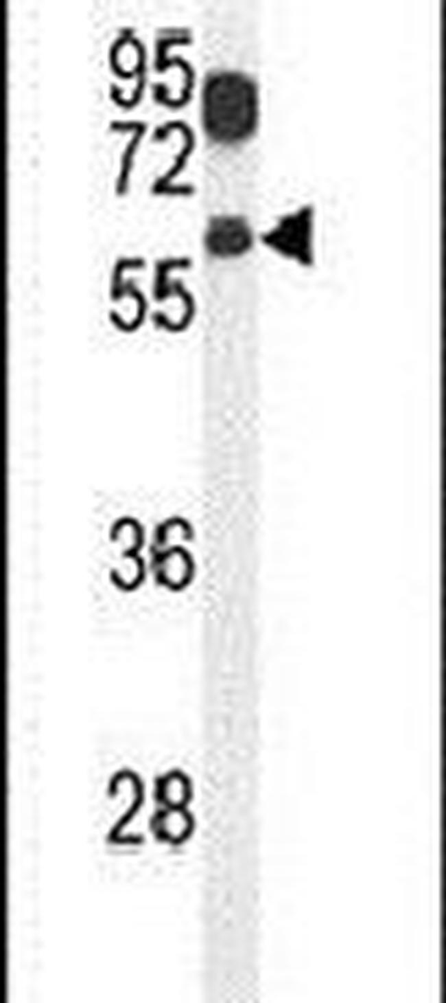 ZACN Antibody in Western Blot (WB)