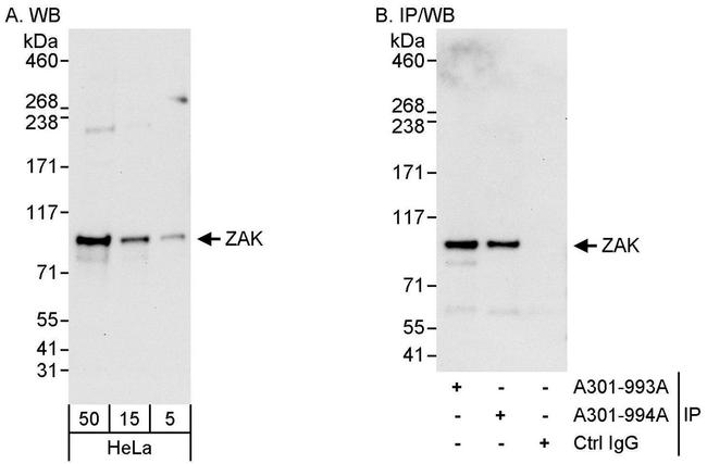 https://www.thermofisher.com/antibody/images/650/ZAK-Antibody-WB-IP-Bethyl-Laboratories-A301-993A-1-20180803145406.jpg?time=20220826