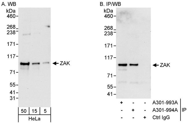 ZAK Antibody in Western Blot (WB)