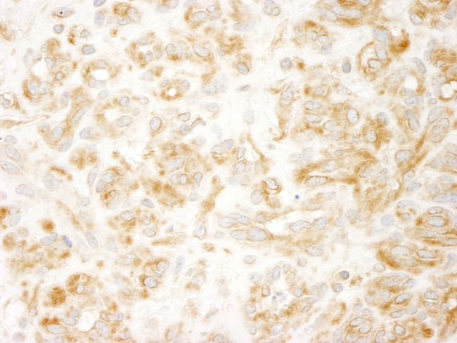 ZAK Antibody in Immunohistochemistry (IHC)