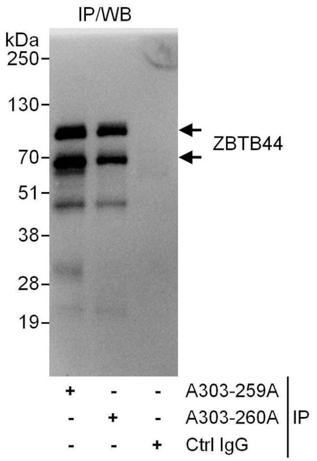 ZBTB44 Antibody in Immunoprecipitation (IP)