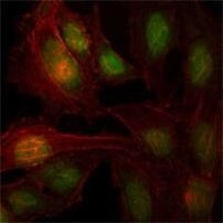 ThPOK Antibody in Immunocytochemistry (ICC/IF)