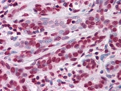 ThPOK Antibody in Immunohistochemistry (Paraffin) (IHC (P))