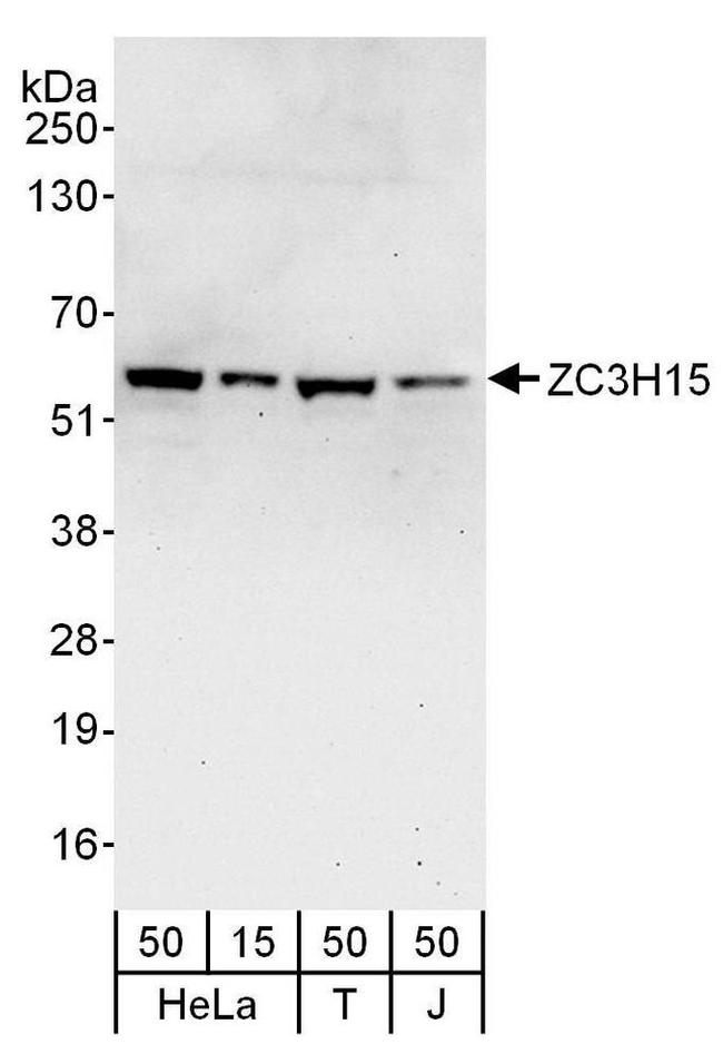 ZC3H15 Antibody in Western Blot (WB)