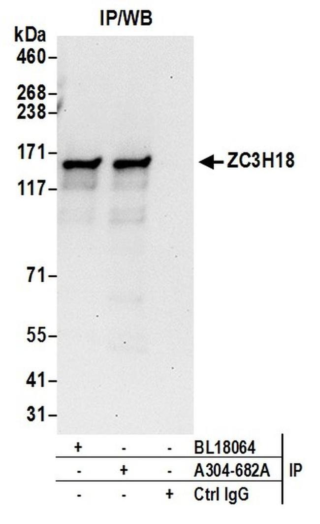 ZC3H18 Antibody in Western Blot (WB)