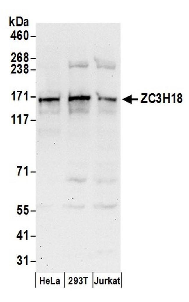 ZC3H18 Antibody in Western Blot (WB)