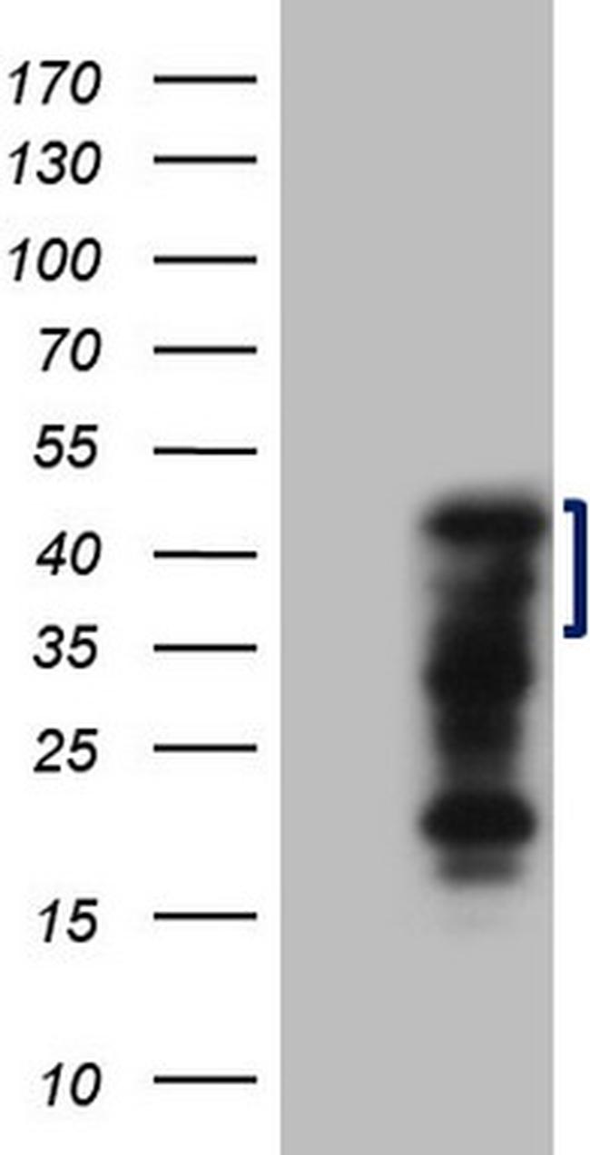 ZC3H8 Antibody in Western Blot (WB)