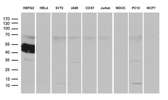 ZCCHC17 Antibody in Western Blot (WB)