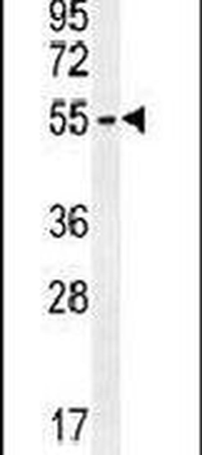 ZDHHC1 Antibody in Western Blot (WB)