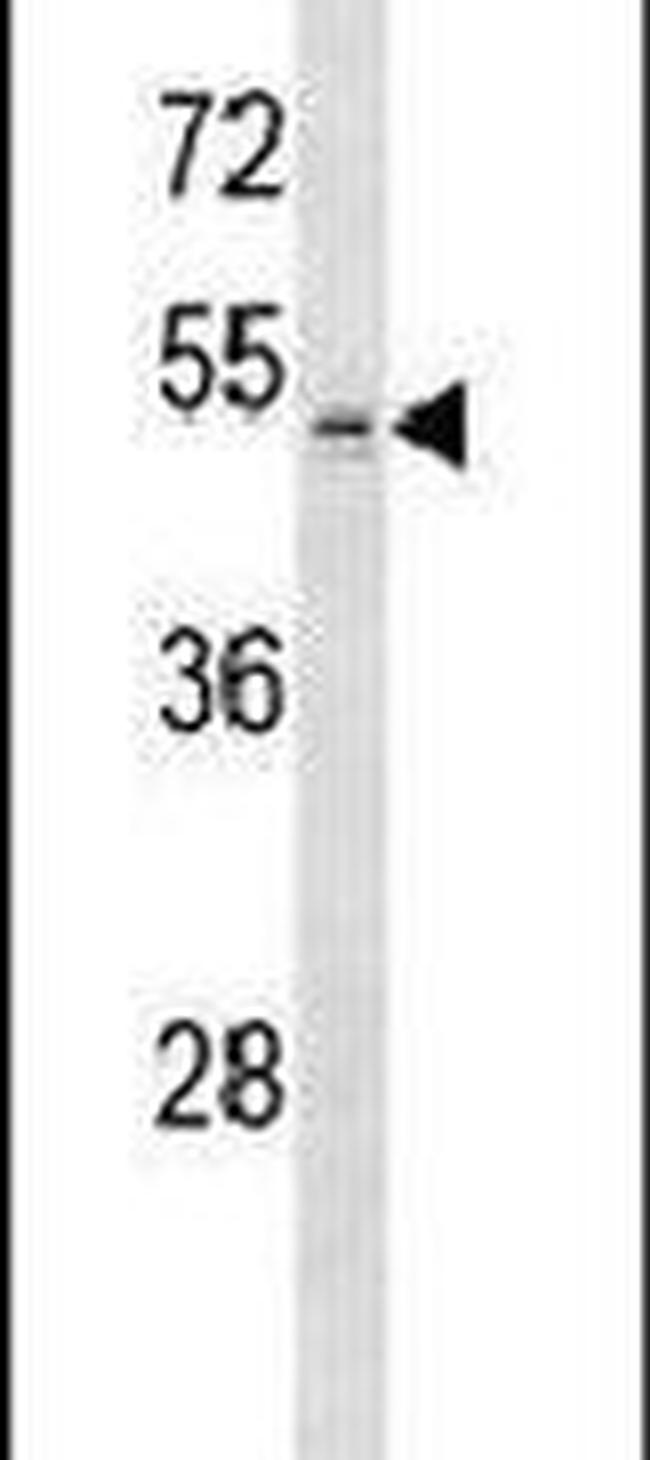 ZDHHC1 Antibody in Western Blot (WB)