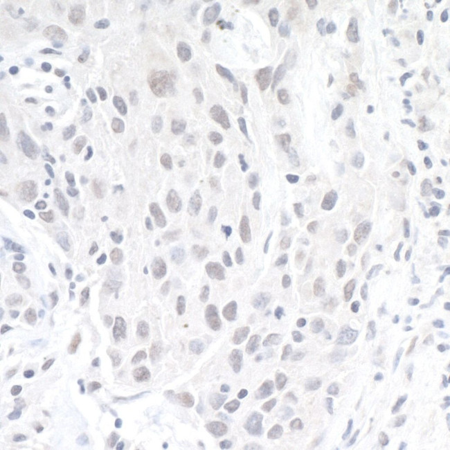 ZEB1 Antibody in Immunohistochemistry (IHC)