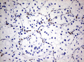 ZEB1 Antibody in Immunohistochemistry (Paraffin) (IHC (P))