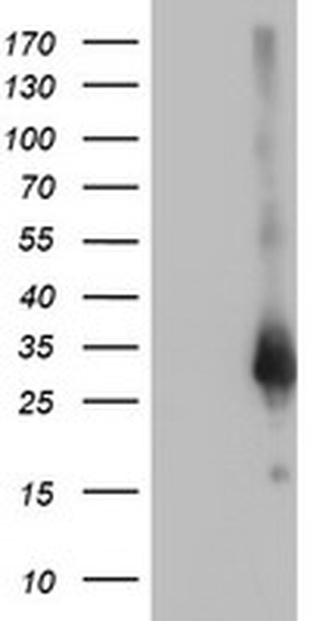 ZFAND2B Antibody in Western Blot (WB)