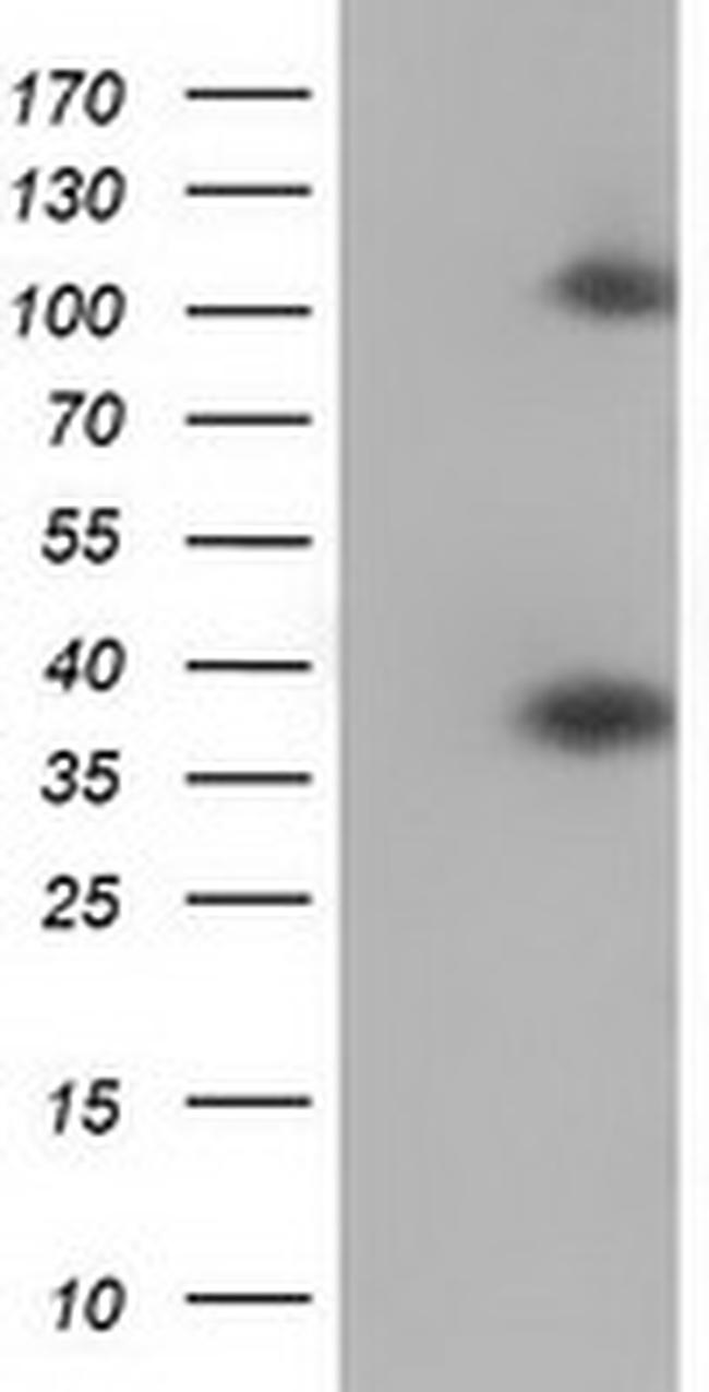 ZFP36 Antibody in Western Blot (WB)
