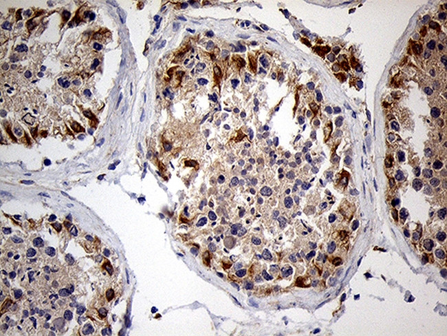 ZFP57 Antibody in Immunohistochemistry (Paraffin) (IHC (P))