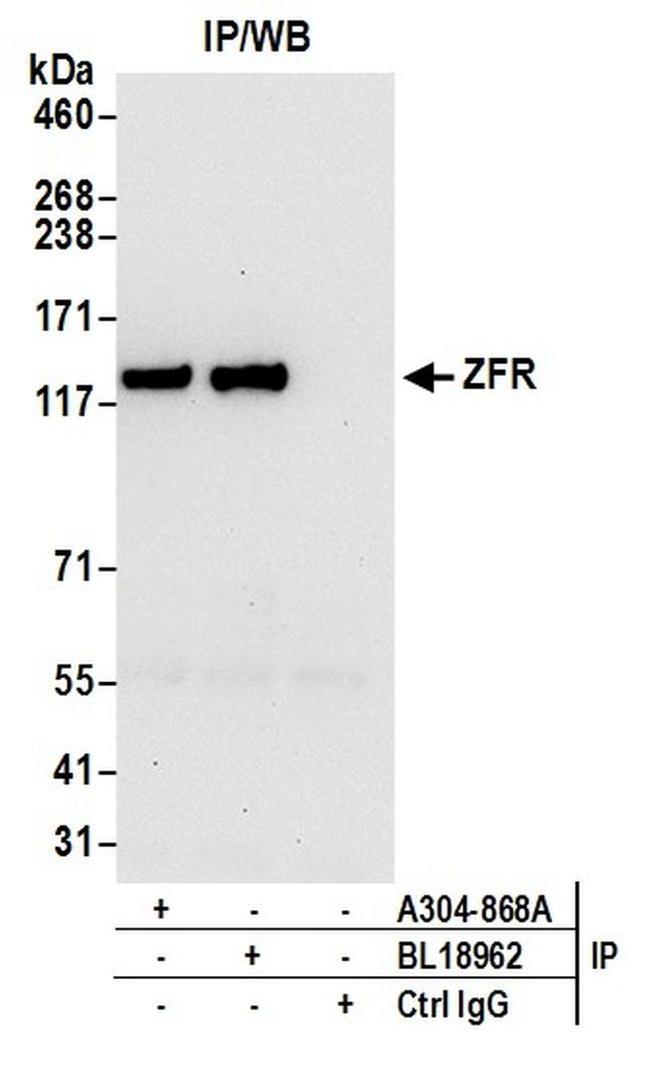 ZFR Antibody in Western Blot (WB)