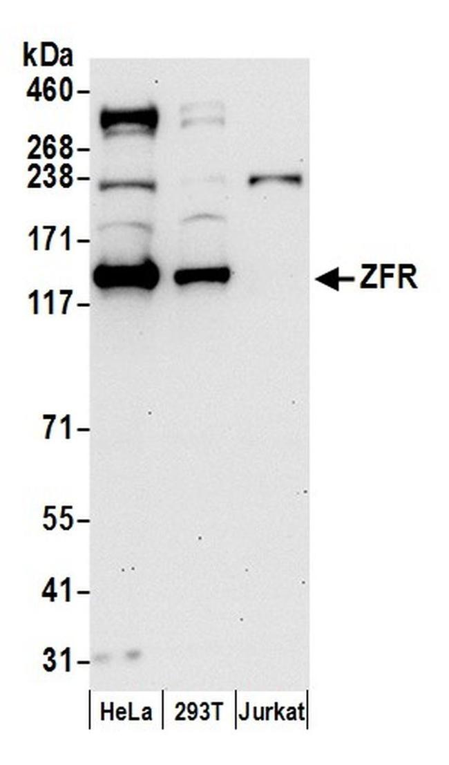 ZFR Antibody in Western Blot (WB)