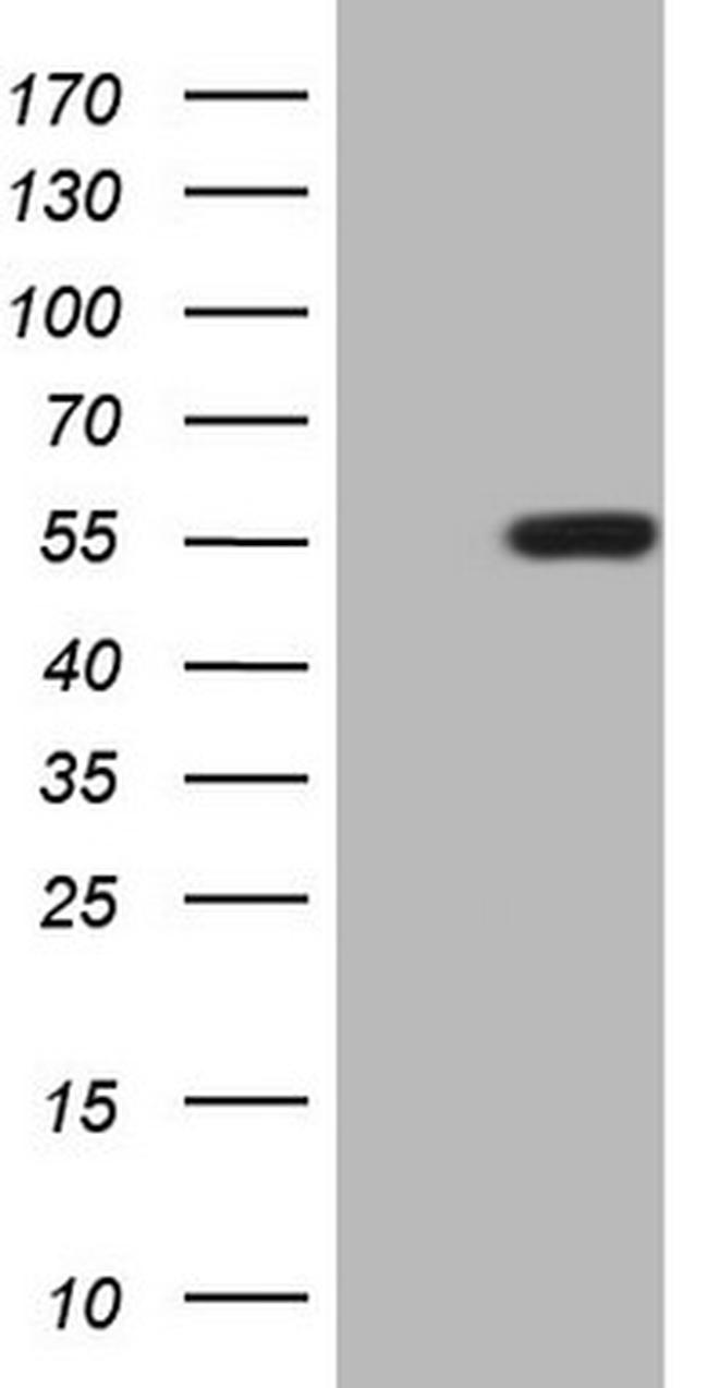 ZIC3 Antibody in Western Blot (WB)