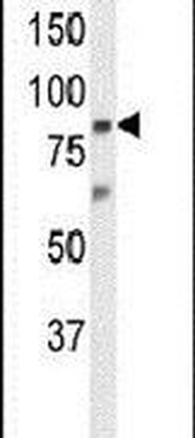 ZNF160 Antibody in Western Blot (WB)