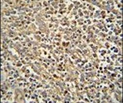 ZNF180 Antibody in Immunohistochemistry (IHC)