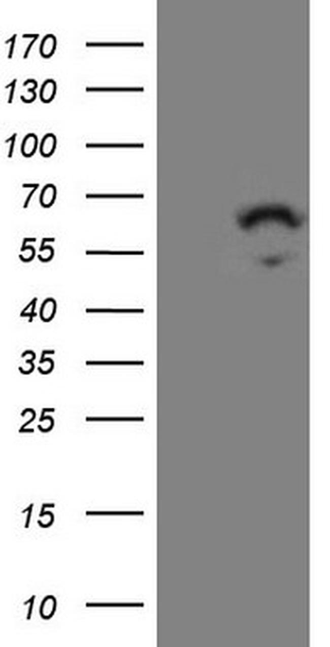 ZNF230 Antibody in Western Blot (WB)