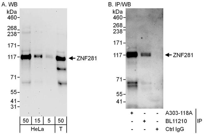 ZNF281 Antibody in Western Blot (WB)