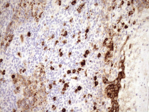 ZNF35 Antibody in Immunohistochemistry (Paraffin) (IHC (P))