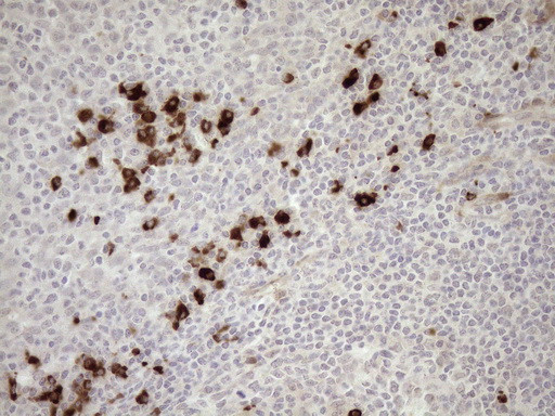 ZNF35 Antibody in Immunohistochemistry (Paraffin) (IHC (P))