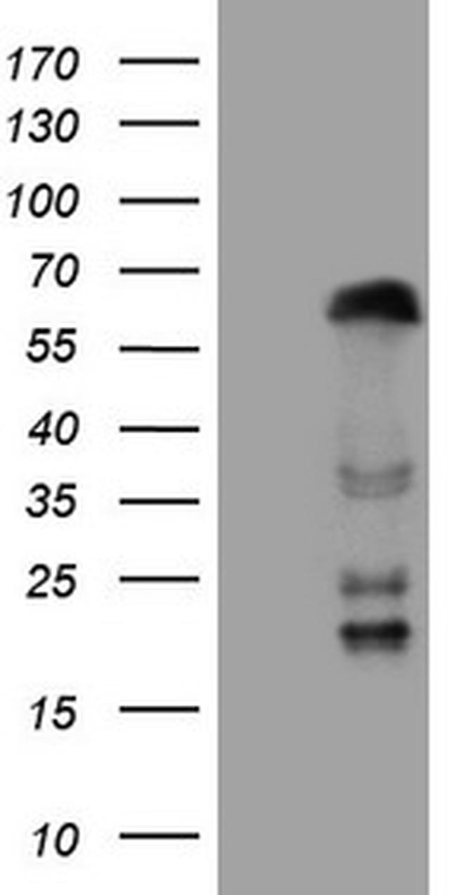 ZNF35 Antibody in Western Blot (WB)