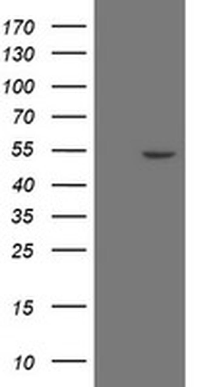 ZNF365 Antibody in Western Blot (WB)