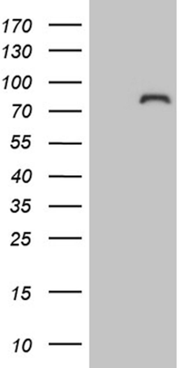 ZNF449 Antibody in Western Blot (WB)